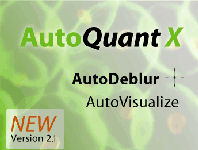 GT Vision Deconvolution Systems GT Vision Deconvolution Systems