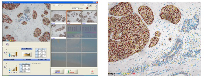 IHC Scoring Screenshot