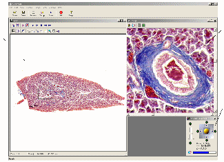 GT HistoVision Surveyor